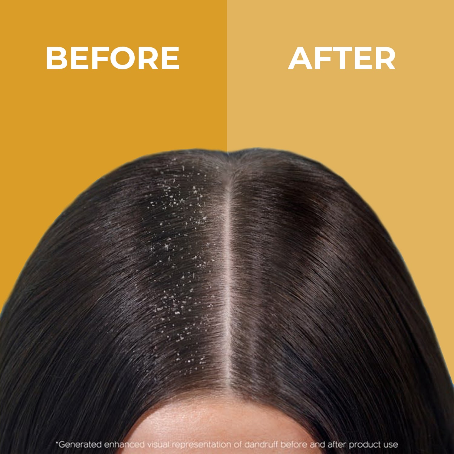 Anti Dandruff Hair oil | Tea Tree & Brazil Nut Oil |The Organic Forest Anti Dandruff Hair oil | Tea Tree & Brazil Nut Oil |The Organic Forest